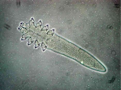 Microscopisch beeld van een Demodex folliculorum-mijt, die huiddemodicose en ooglidontsteking kan veroorzaken.