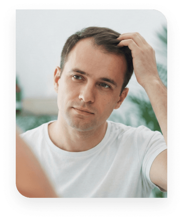A front view of a man in a white t-shirt looking at his reflection in a mirror while running his fingers through his hair, inspecting his hairline or scalp concern.